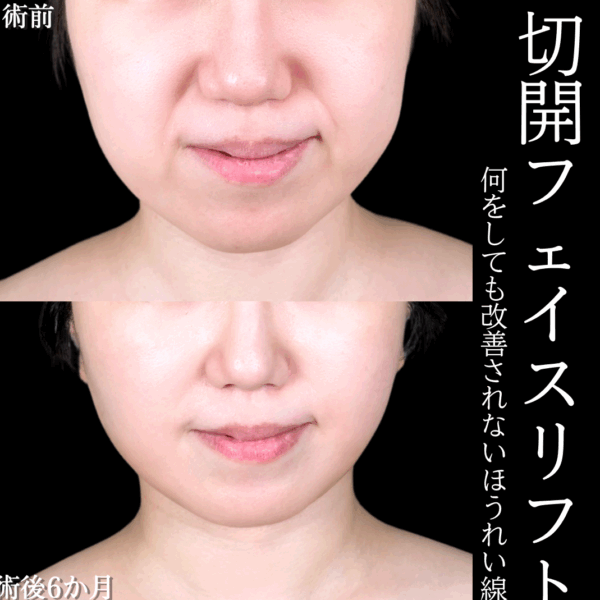 No.15797の症例写真